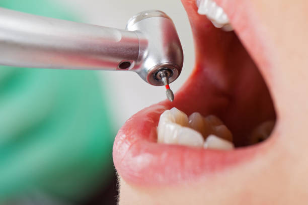 Best Emergency Gum Treatment in Gibson City, IL